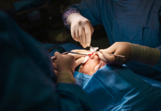 5 sai lầm phổ biến khi nâng mũi khiến dáng mũi kém tự nhiên