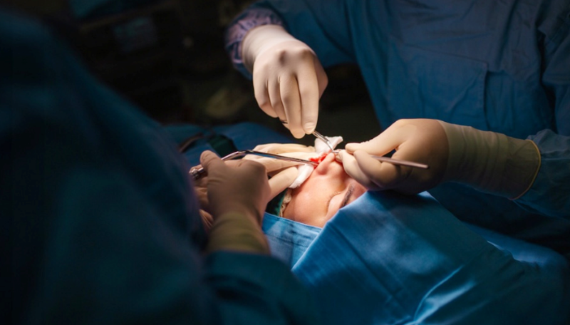 5 sai lầm phổ biến khi nâng mũi khiến dáng mũi kém tự nhiên