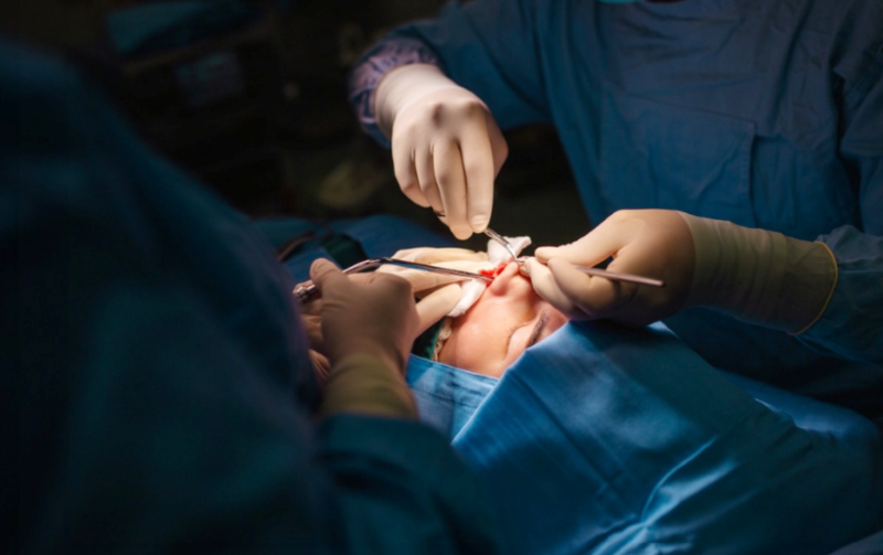 5 sai lầm phổ biến khi nâng mũi khiến dáng mũi kém tự nhiên