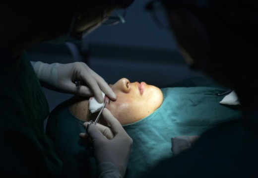 Case study: Từ thẩm mỹ hỏng → phục hồi & cải thiện như thế nào?