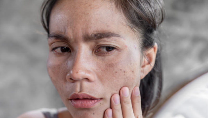 Lão hóa khuôn mặt: Hiểu đúng để lựa chọn đúng - BS Phạm Hồ Nam