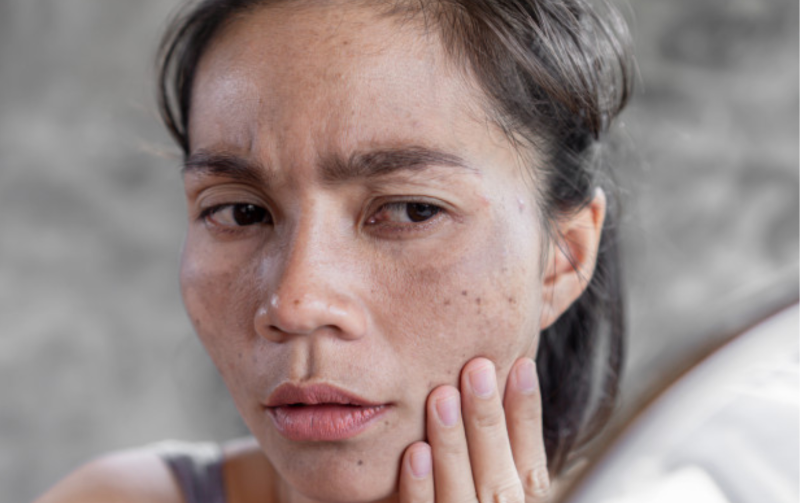 Lão hóa khuôn mặt: Hiểu đúng để lựa chọn đúng - BS Phạm Hồ Nam