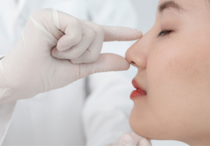 Nâng mũi cấu trúc: Khi nào thực sự cần và ai không nên làm?