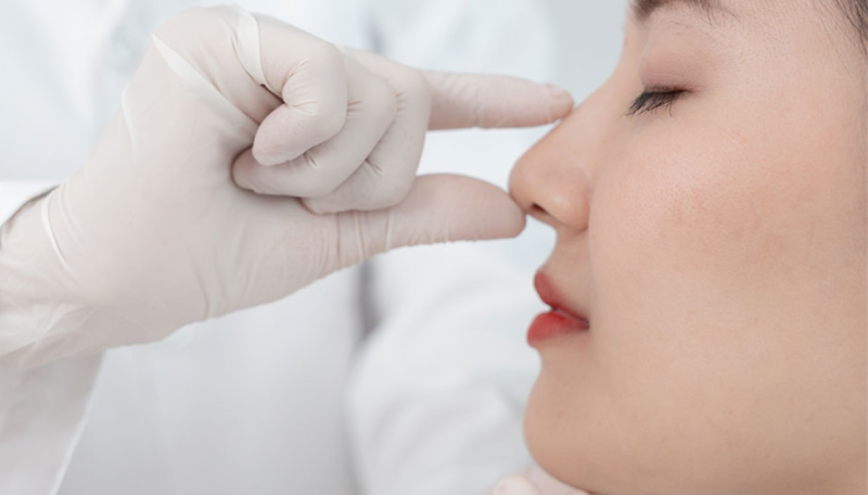 Nâng mũi cấu trúc: Khi nào thực sự cần và ai không nên làm?