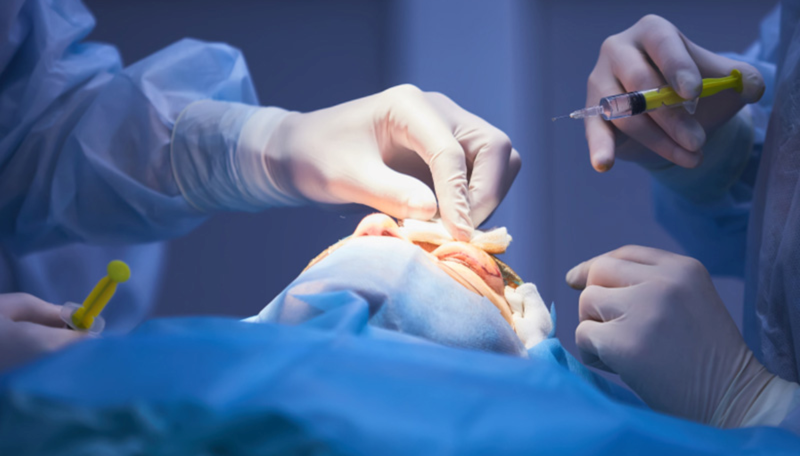 Chỉnh sửa thẩm mỹ hỏng theo BS Hồ Nam khó hơn làm lần đầu như thế nào?