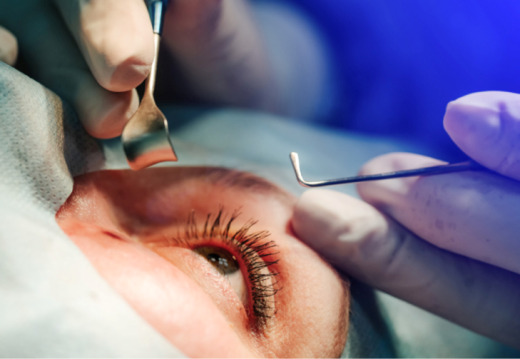 Vì sao thẩm mỹ bị hỏng? – 5 nguyên nhân bác sĩ Phạm Hồ Nam thường gặp