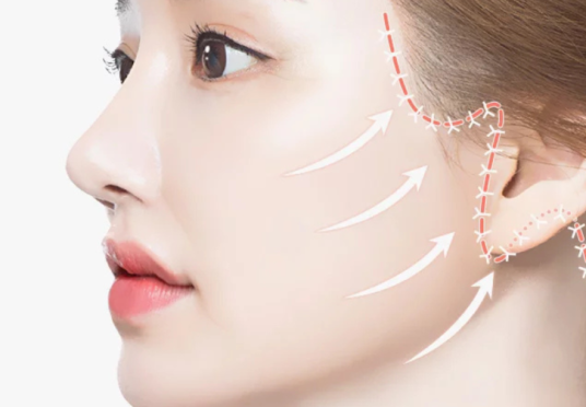 Phẫu thuật căng da mặt: Phương pháp trẻ hóa da toàn diện và lâu dài