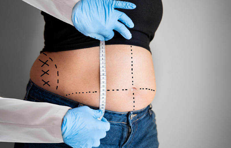 Bác sĩ Phạm Hồ Nam đánh giá tình trạng mỡ thừa