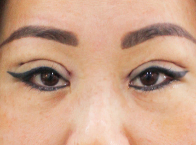 Bác sĩ tái phẫu thuật thẩm mỹ tại TP.HCM – Thạc sĩ, Bác sĩ Phạm Hồ Nam