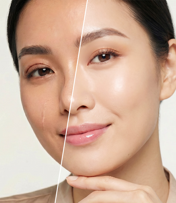 Dịch vụ chỉnh sửa thẩm mỹ hỏng - BS Phạm Hồ Nam