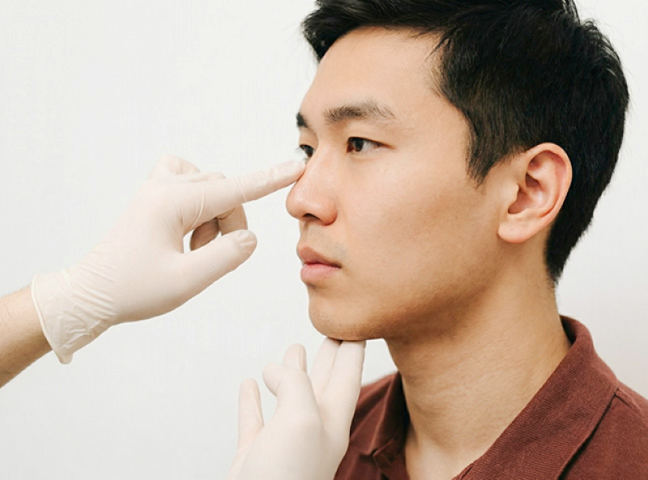 Nâng mũi cho nam có gì khác - Bác sĩ Hồ Nam