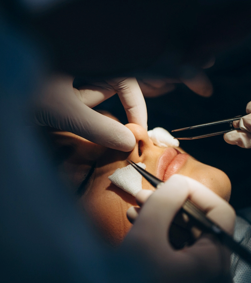 Nâng mũi đẹp tự nhiên – Thạc sĩ, Bác sĩ Phạm Hồ Nam