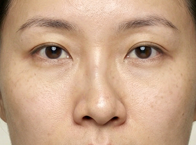 Phẫu thuật chỉnh sửa thẩm mỹ tại TP.HCM – Thạc sĩ, Bác sĩ Phạm Hồ Nam