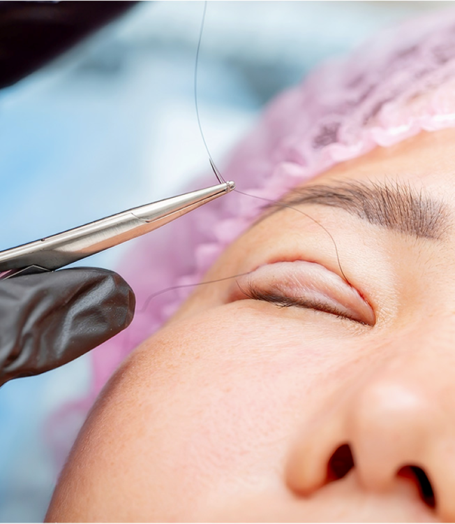 Phẫu thuật thẩm mỹ mắt tại TP.HCM – Thạc sĩ, Bác sĩ Phạm Hồ Nam