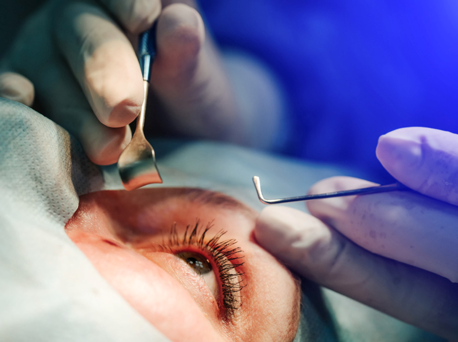 Thẩm mỹ mắt tại TP.HCM – Thạc sĩ, Bác sĩ Phạm Hồ Nam