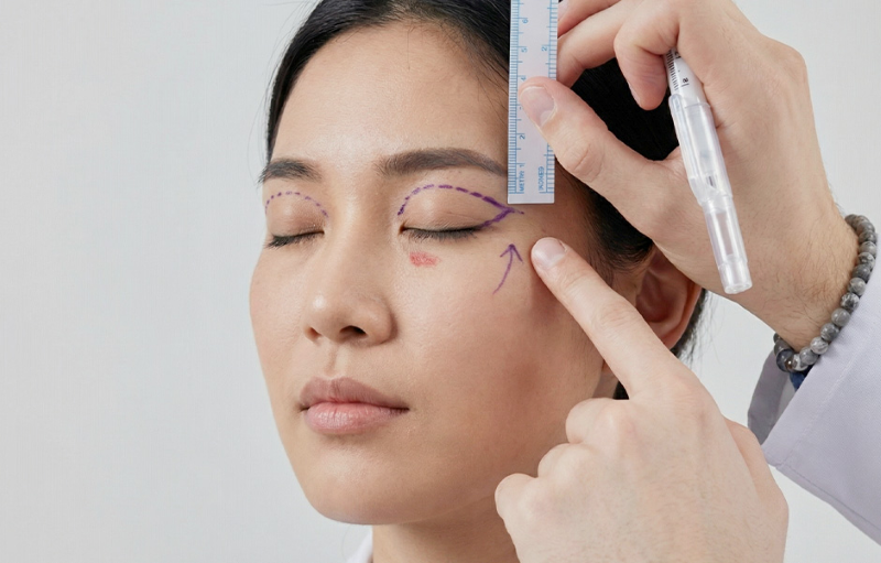 Bác sĩ Phạm Hồ Nam tư vấn cắt mí